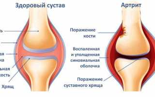 Строение и функции синовиальной оболочки