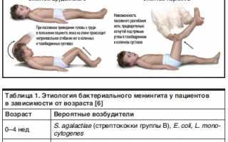 Менингеальные симптомы: симптом Кернига и Брудзинского