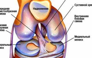 Дегенеративные повреждения заднего рога медиального мениска