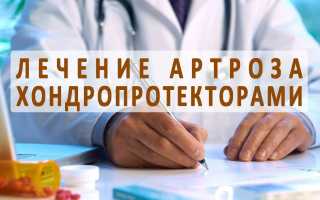 Хондропротекторные препараты при коксартрозе