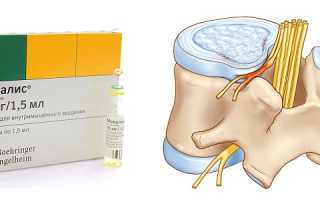 Мовалис от грыжы позвоночника