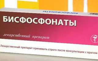 Бисфосфонаты при остеопорозе