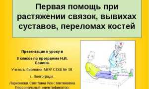 Первая медицинская помощь при вывихе сустава