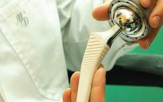 Тазобедренный эндопротез Depuy