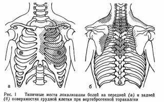 Торакалгия — что это за болезнь?